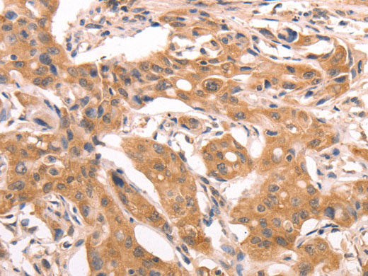 AASDHPPT Polyclonal Antibody Store at -20°C