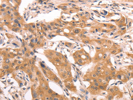AASDHPPT Polyclonal Antibody Store at -20°C