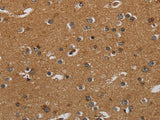 HSD17B2 Polyclonal Antibody Store at -20°C