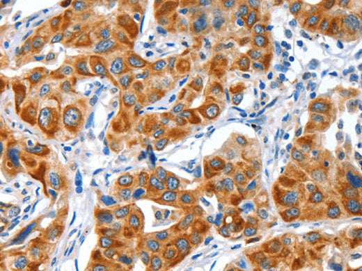 VWA5A Polyclonal Antibody Store at -20°C
