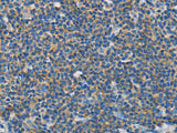 NEK5 Polyclonal Antibody