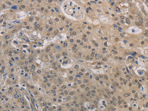 DPYSL3 Polyclonal Antibody Store at -20°C