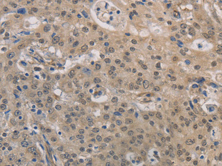 DPYSL3 Polyclonal Antibody Store at -20°C