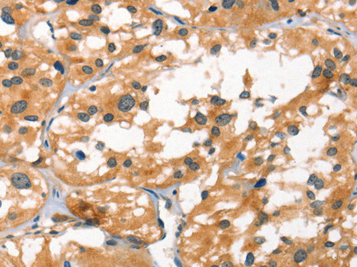 SMAD3 Polyclonal Antibody Store at -20°C