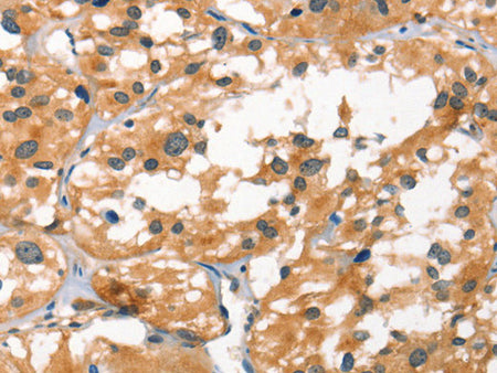 SMAD3 Polyclonal Antibody Store at -20°C