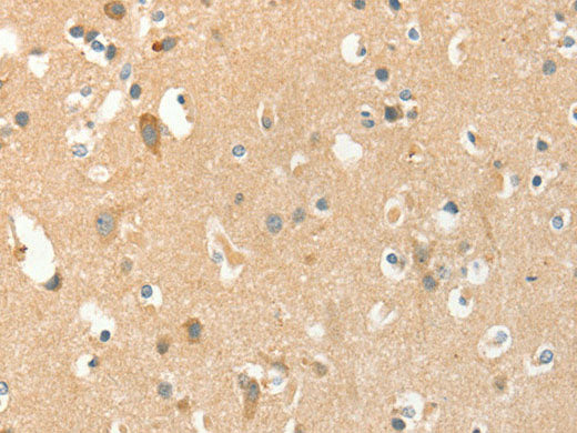 AANAT Polyclonal Antibody Store at -20°C
