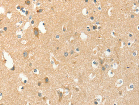 AANAT Polyclonal Antibody Store at -20°C