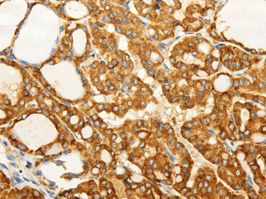 FZD6 Polyclonal Antibody Store at -20°C