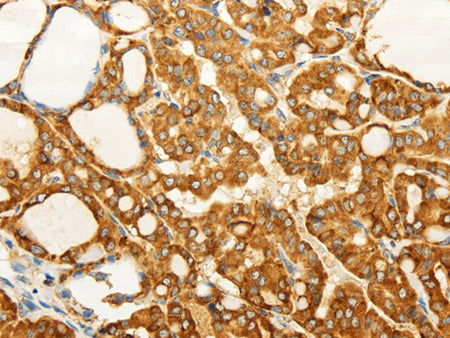 FZD6 Polyclonal Antibody Store at -20°C