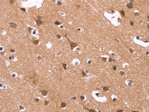 HSD17B1 Polyclonal Antibody Store at -20°C