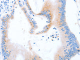 STK4 Polyclonal Antibody Store at -20°C