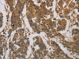 CORO1C Polyclonal Antibody Store at -20°C