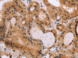 EPDR1 Polyclonal Antibody