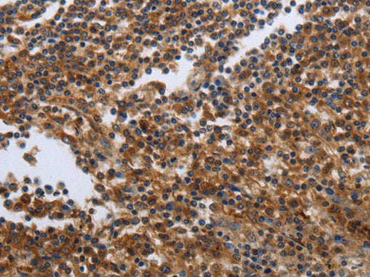PDCD2 Polyclonal Antibody Store at -20°C