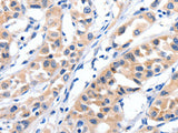 JAK2 Polyclonal Antibody Store at -20°C