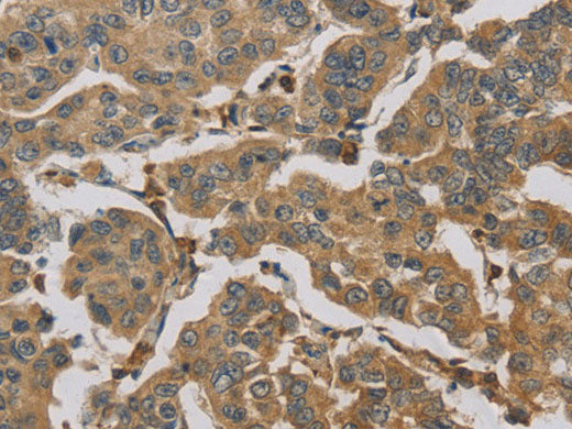 TBXAS1 Polyclonal Antibody Store at -20°C