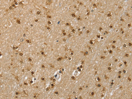 RNH1 Polyclonal Antibody Store at -20°C