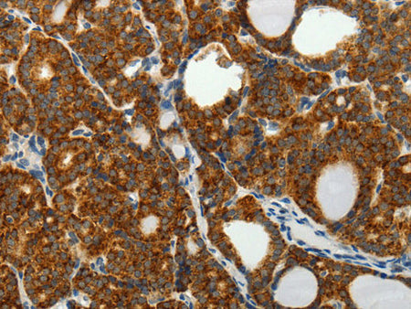 SELENOM Polyclonal Antibody Reactivity Human, Mouse