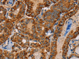 MBNL3 Polyclonal Antibody