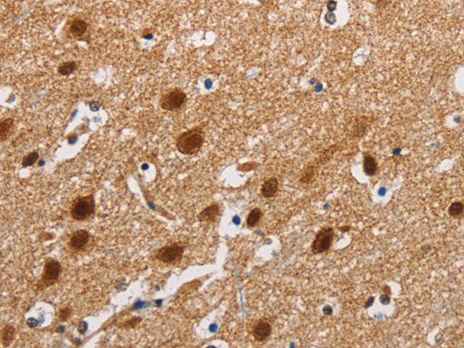 ATXN1 Polyclonal Antibody Store at -20°C