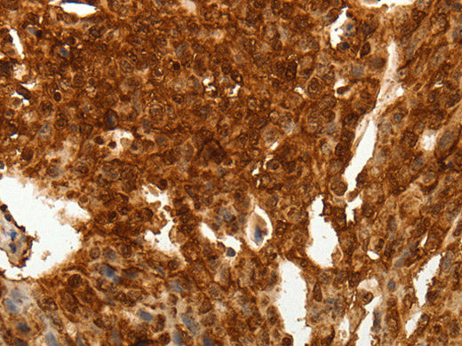 TENM3 Polyclonal Antibody Store at -20°C