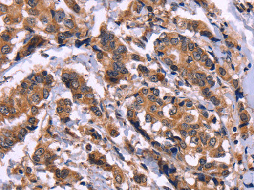 AMIGO2 Polyclonal Antibody Store at -20°C