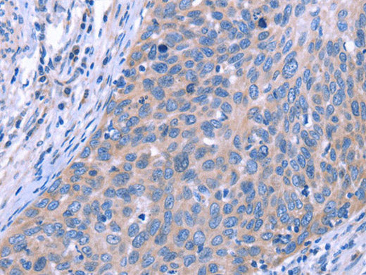 ESPL1 Polyclonal Antibody Store at -20°C