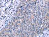 ESPL1 Polyclonal Antibody Store at -20°C