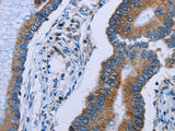 IDH2 Polyclonal Antibody Store at -20°C