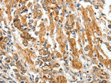 TGF β Receptor I Polyclonal Antibody Store at -20°C