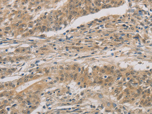 DDIT4 Polyclonal Antibody Store at -20°C