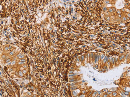 BRS3 Polyclonal Antibody Store at -20°C