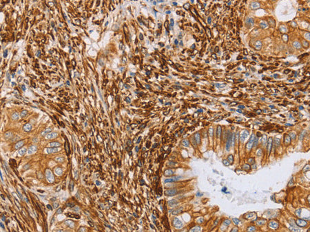 BRS3 Polyclonal Antibody Store at -20°C