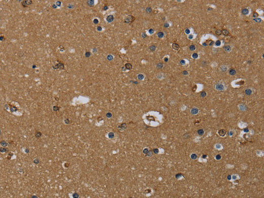 GBP5 Polyclonal Antibody