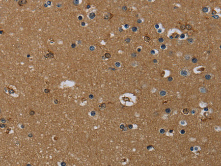 GBP5 Polyclonal Antibody