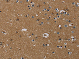 GBP5 Polyclonal Antibody