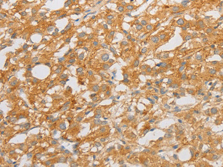 NGF Polyclonal Antibody Store at -20°C