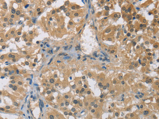 TNFRSF10D Polyclonal Antibody Store at -20°C