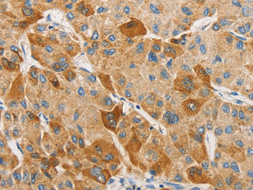 APOBEC3G Polyclonal Antibody Store at -20°C