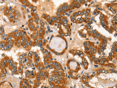 IKZF3 Polyclonal Antibody Store at -20°C