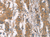 PLIN2 Polyclonal Antibody Store at -20°C