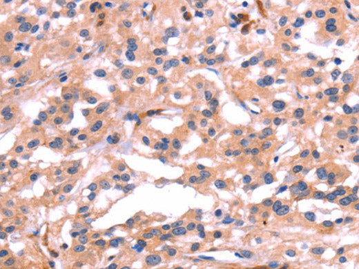 PTPN13 Polyclonal Antibody
