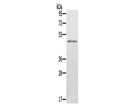 KDM8 Polyclonal Antibody