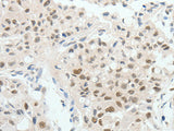 HNF1B Polyclonal Antibody Store at -20°C