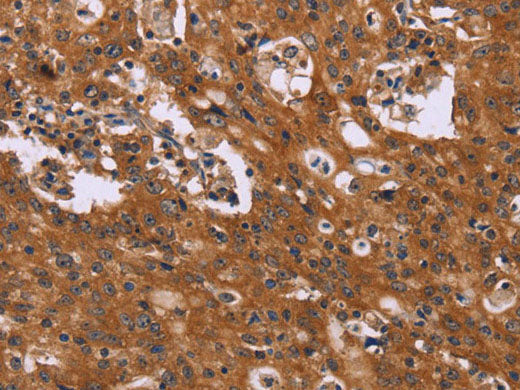 CMTM6 Polyclonal Antibody Store at -20°C