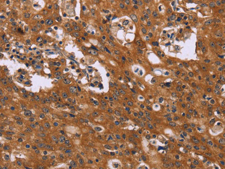 CMTM6 Polyclonal Antibody Store at -20°C
