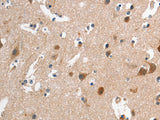 CD168 Polyclonal Antibody