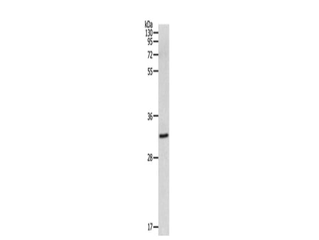 MMP26 Polyclonal Antibody Store at -20°C