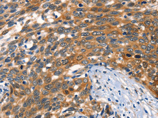 AGO1 Polyclonal Antibody Store at -20°C