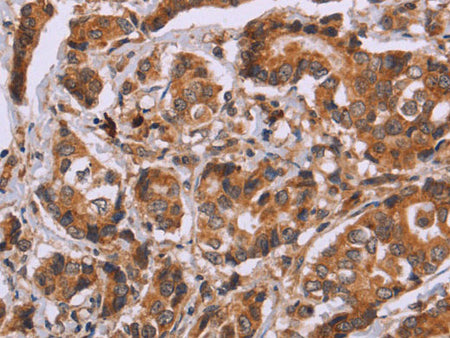 CALCA Polyclonal Antibody Store at -20°C
